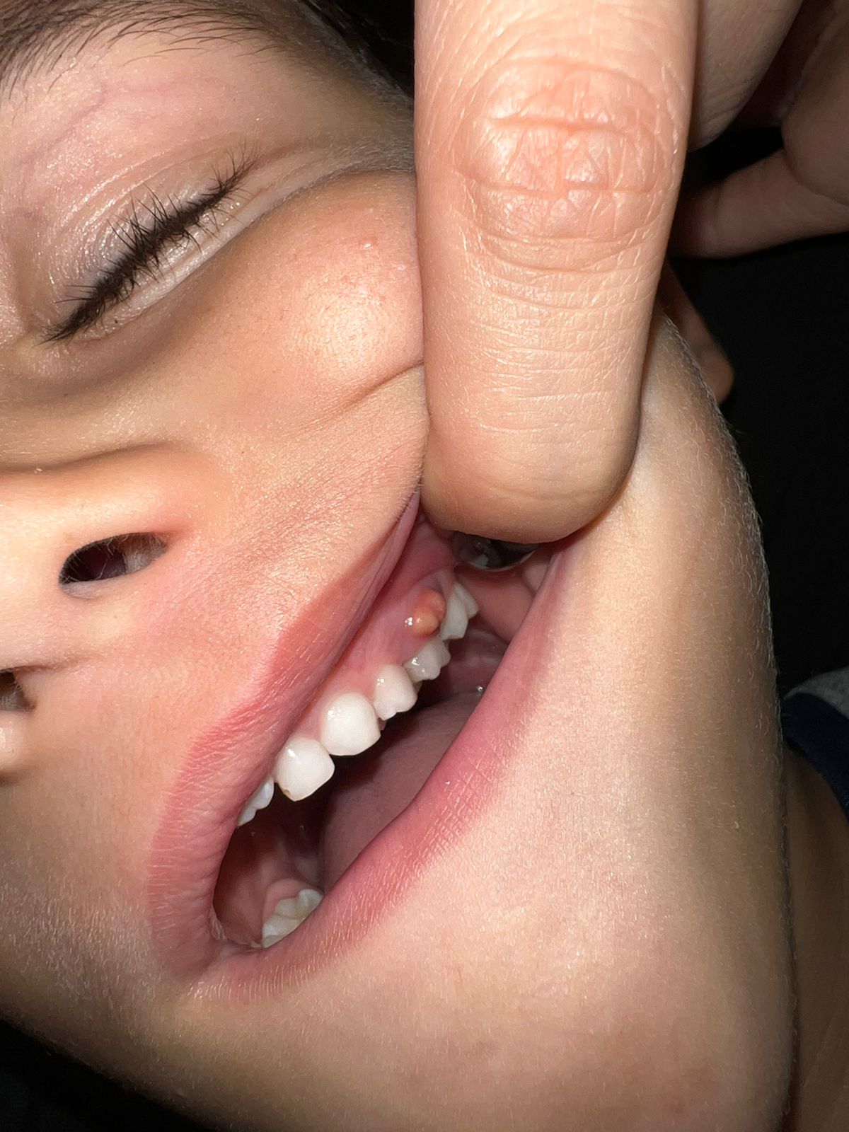 Odontopediatria